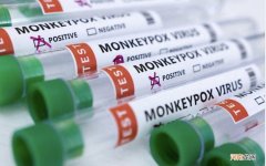 欧洲首现猴痘死亡病例 哪些人群会引起严重疾病？