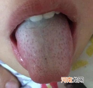 奶奶带娃6年，孩子未见积食！医生：谨记这“2事”，脾胃壮如牛