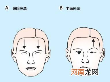 申时右眼跳是怎么回事 申时右眼一直跳