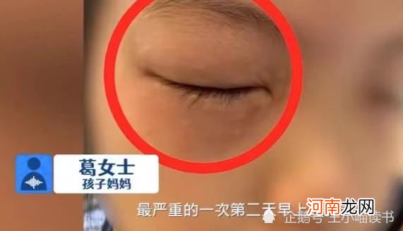 天下之大无奇不有：9岁女儿做数学题过敏，母亲在线求支招儿