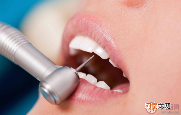 洗牙|洗牙会不会有危害 洗牙后牙齿酸软怎么回事