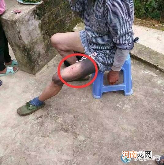 梦到蛇咬自己腿是什么征兆女性 女人梦到蛇咬自己腿预示着什么