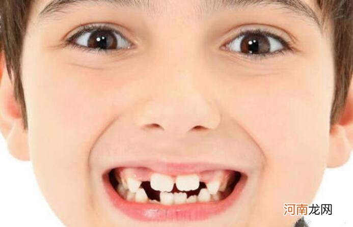 最全儿童换牙时间表：儿童换牙何时开始、何时结束？一图说清