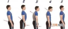 快速矫正驼背的4个方法 青少年驼背怎么矫正
