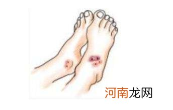 梦到蛇咬自己腿我把蛇弄死 梦到我把蛇咬死了