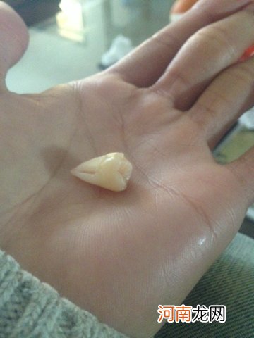 智齿运势 智齿的状况