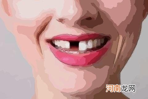 早上梦见掉牙齿是什么征兆女人 梦见掉牙齿是什么征兆