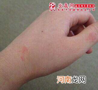 周公解梦梦见红蛇 周公解梦梦见红蛇在身体里