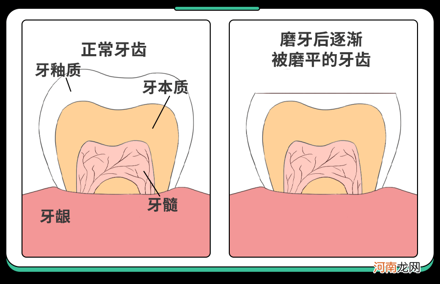 孩子磨牙别大意，3种磨牙类型要识别，别让“后遗症”毁脸又毁牙