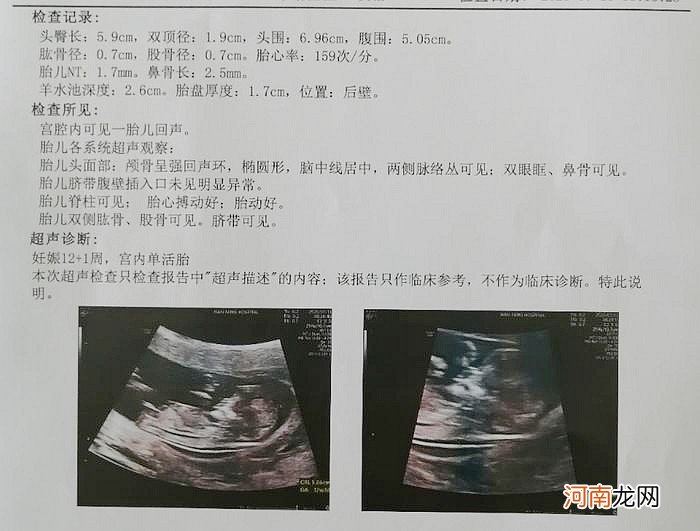 怀孕后，什么时候能够检测出来胎儿发育不良？孕妈知道越早越好