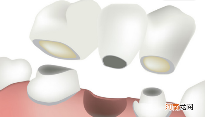 梦见掉牙齿是什么征兆 梦见掉牙齿是什么征兆不疼