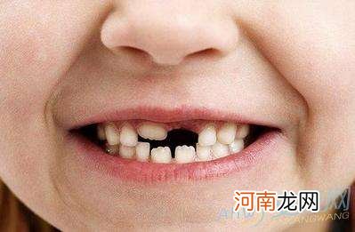 周公解梦牙齿松动 周公解梦牙齿松动脱落好几个