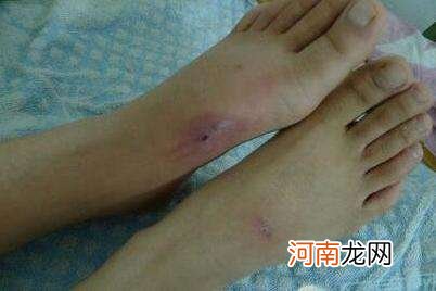 孩子梦见被蛇咬了是什么征兆 梦见自己小孩被蛇咬了是什么征兆