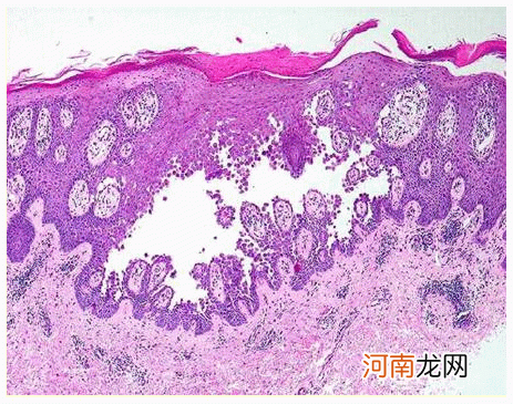 解梦皮肤病 做梦梦到得了皮肤病