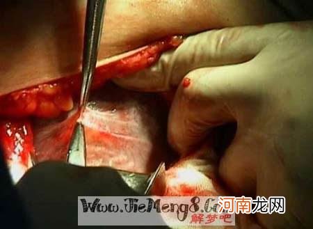 梦见血周公解梦 梦见血什么预兆周公解梦