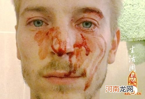 梦见血周公解梦 梦见血什么预兆周公解梦