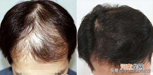 梦到和异性生发关系还有血 梦到和异性生发关系还有血迹