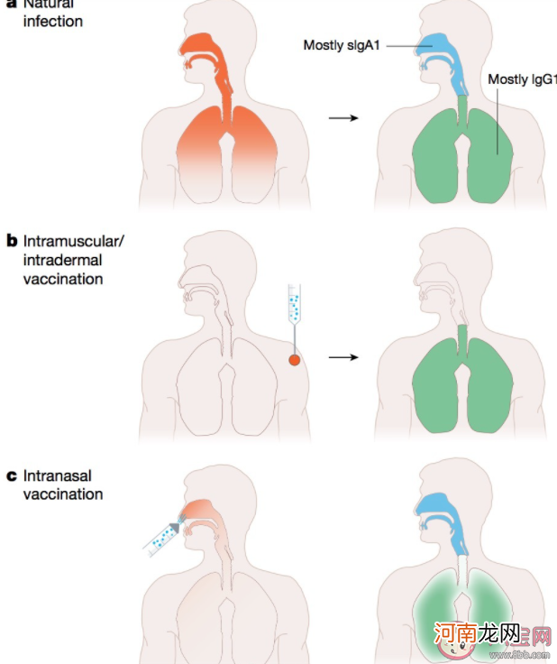 吸入式新冠疫苗获批|吸入式新冠疫苗获批 鼻喷式预防药物也将面世