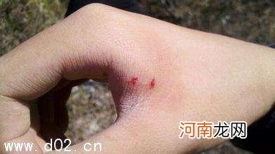 女的梦到蛇咬自己脚 女人梦到蛇咬我脚