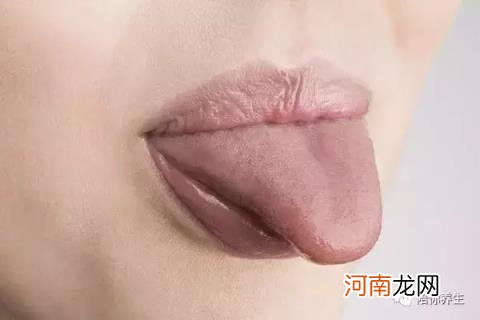 舌苔厚白会自愈吗 舌苔厚白是什么原因