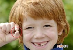 儿童换牙时间段 换牙齿顺序和年龄图