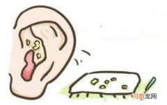 耳屎的形成过程 为什么耳朵会长耳屎