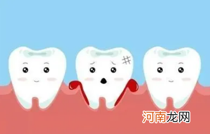 牙齿松动的原因 牙齿为什么会松动