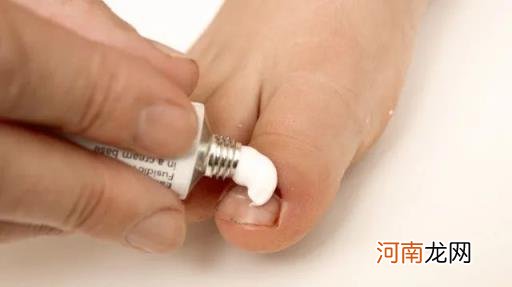 轻度甲沟炎初期照片,甲沟炎反复发作详解?