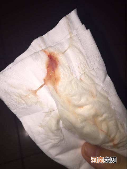 排卵期出血怎么办 长期排卵期出血怎么办