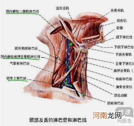 淋巴结发炎怎么办 感冒引起淋巴结发炎怎么办