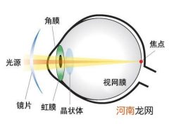 眼睛散光怎么办才能恢复 眼睛散光怎么办才能恢复吃什么