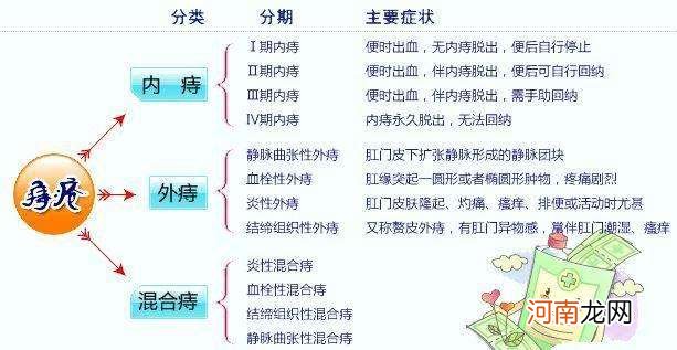 痔疮手术多少钱左右 内外痔疮手术多少钱左右