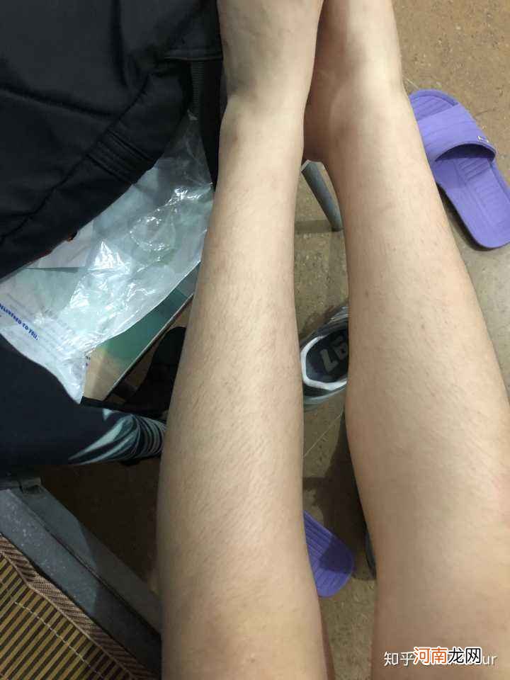 腿毛长怎么办 怎么去腿毛 女生