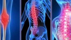 强直性脊柱炎怎么办 强直性脊柱炎怎么办理特殊门诊