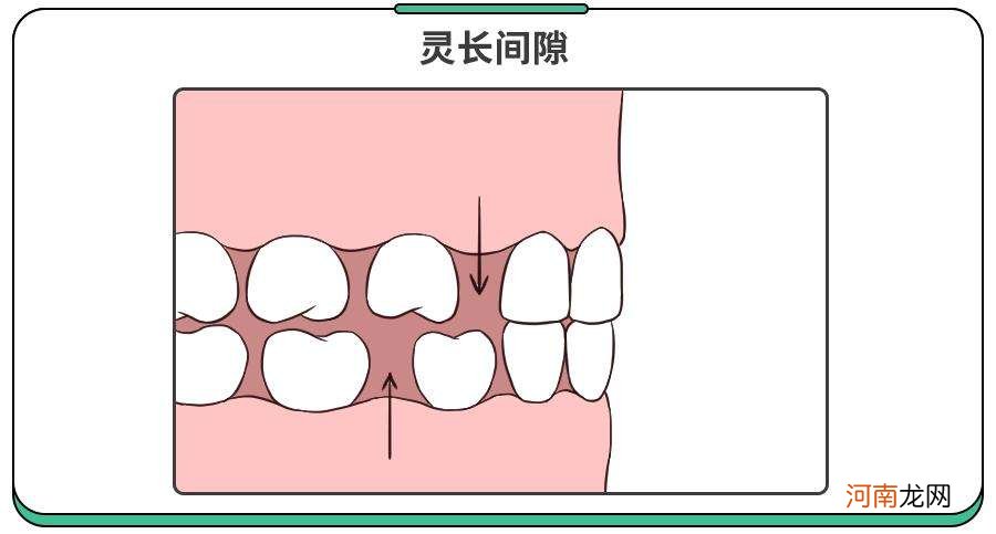 现在换一颗牙要多少钱 现在换一颗牙要多少钱一颗