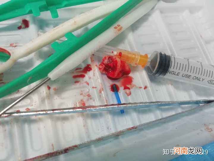 拔智齿多少钱 拔智齿多少钱武汉仁爱怎么去