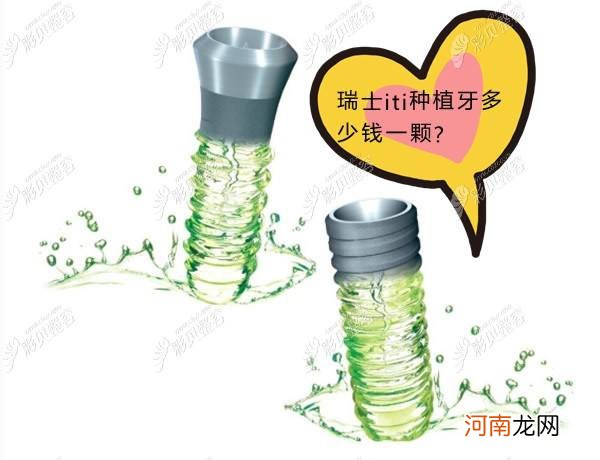 种植牙多少钱 种植牙多少钱一颗2022价格表天津中诺哪里预约