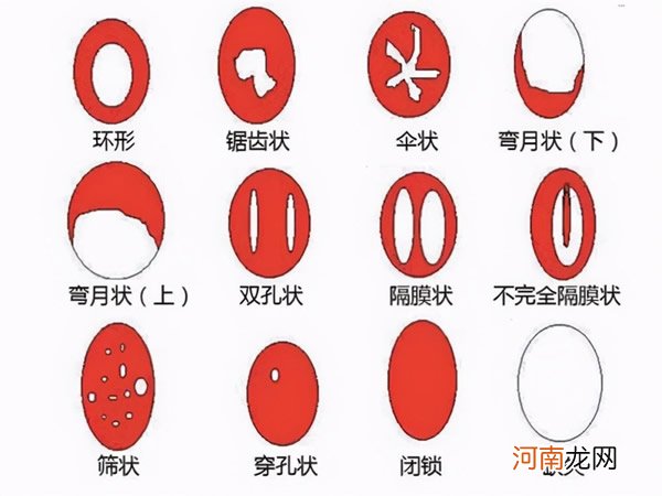 处女膜修复多少钱 女生内膜修复要多少钱