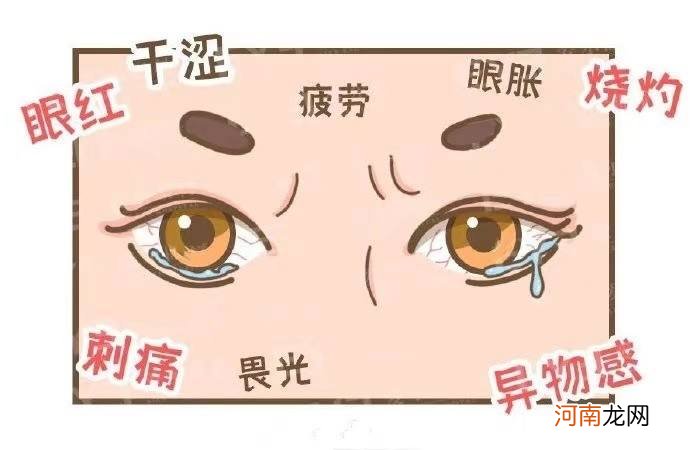 眼睛干痒怎么办 干燥综合征眼睛干痒怎么办