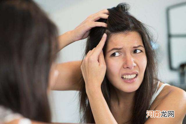 女性脱发怎么办 女性脱发怎么办吃点什么