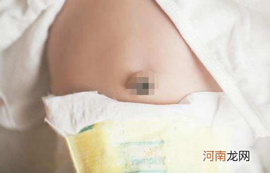婴儿肚脐中“黑色”的脏东西，究竟是什么？能不能清理掉？