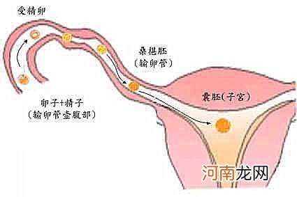 输卵管堵塞怎么办 得了输卵管堵塞怎么办