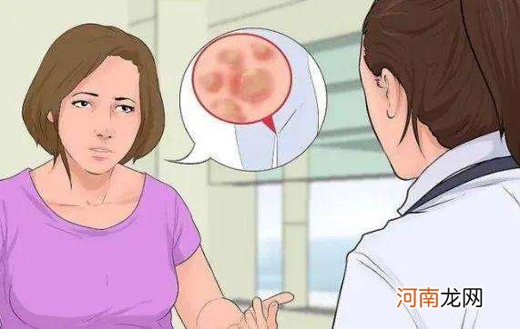 包含尖锐湿疣怎么检测的词条