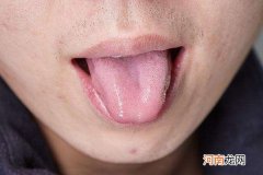 舌头有齿痕是怎么回事 女人舌头有齿痕是怎么回事