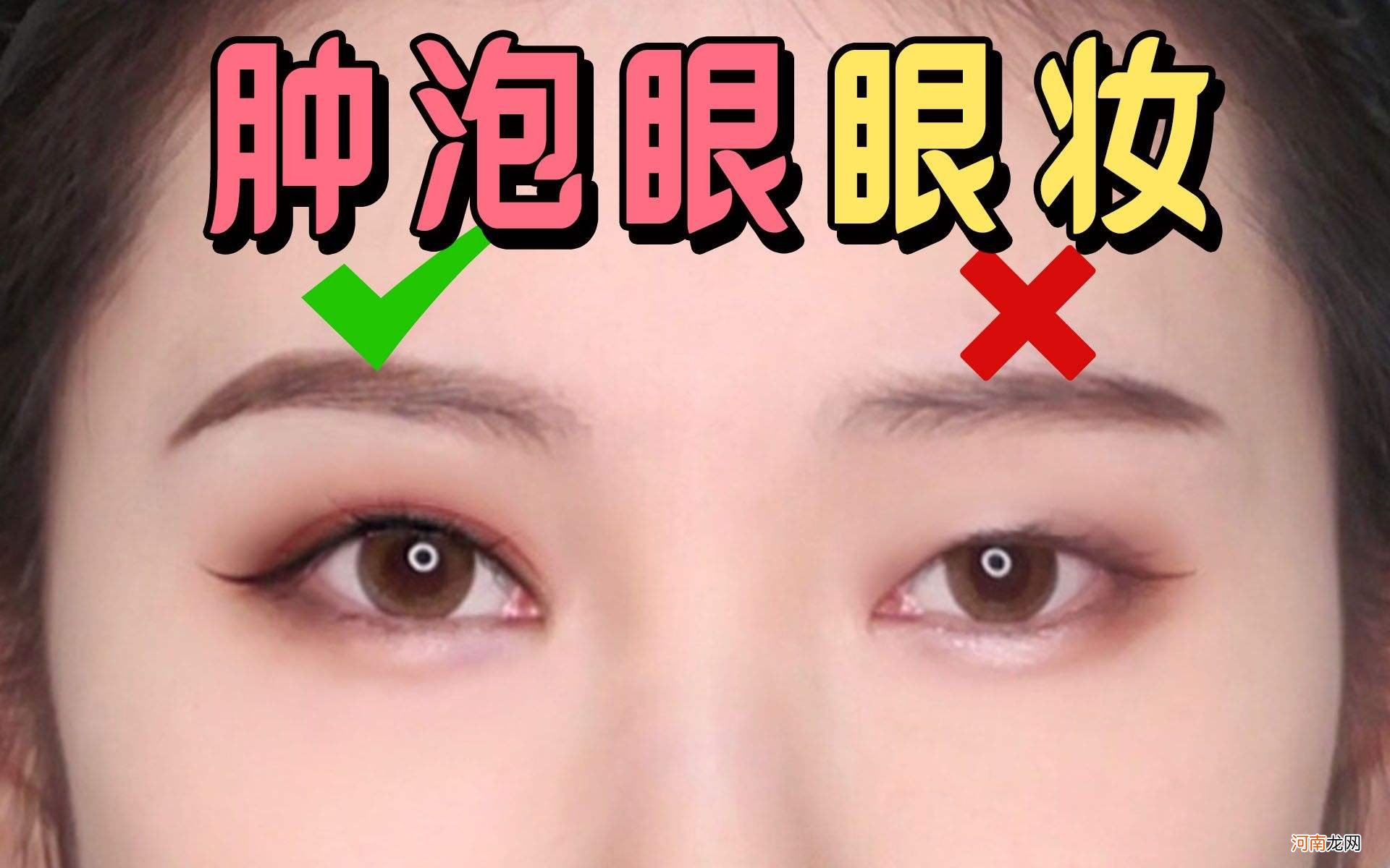 眼睛肿眼泡怎么消除 眼睛肿眼泡是什么原因造成的