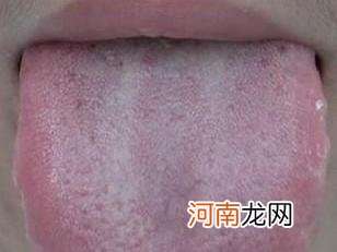 舌苔发白怎么回事 舌头发白是什么原因引起的怎么办
