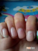 指甲上有白点是怎么回事 三岁宝宝指甲上有白点是怎么回事