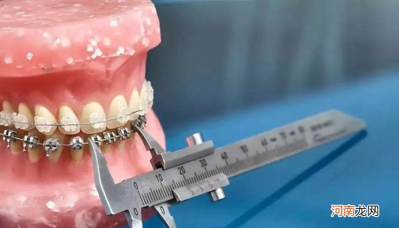 牙齿矫正的最佳时期推荐 校正牙齿年龄是多少岁合适