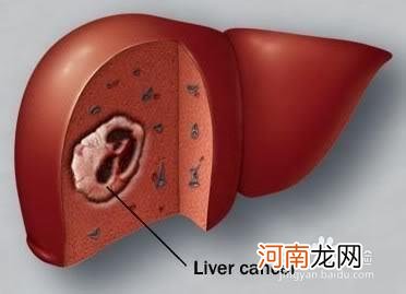 常见内科病之传染病治疗方法:[4]病毒肝炎