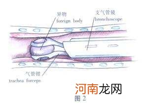 气管是哪里 舌叶支气管是哪里